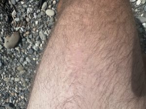 Grieving Scars v1.0