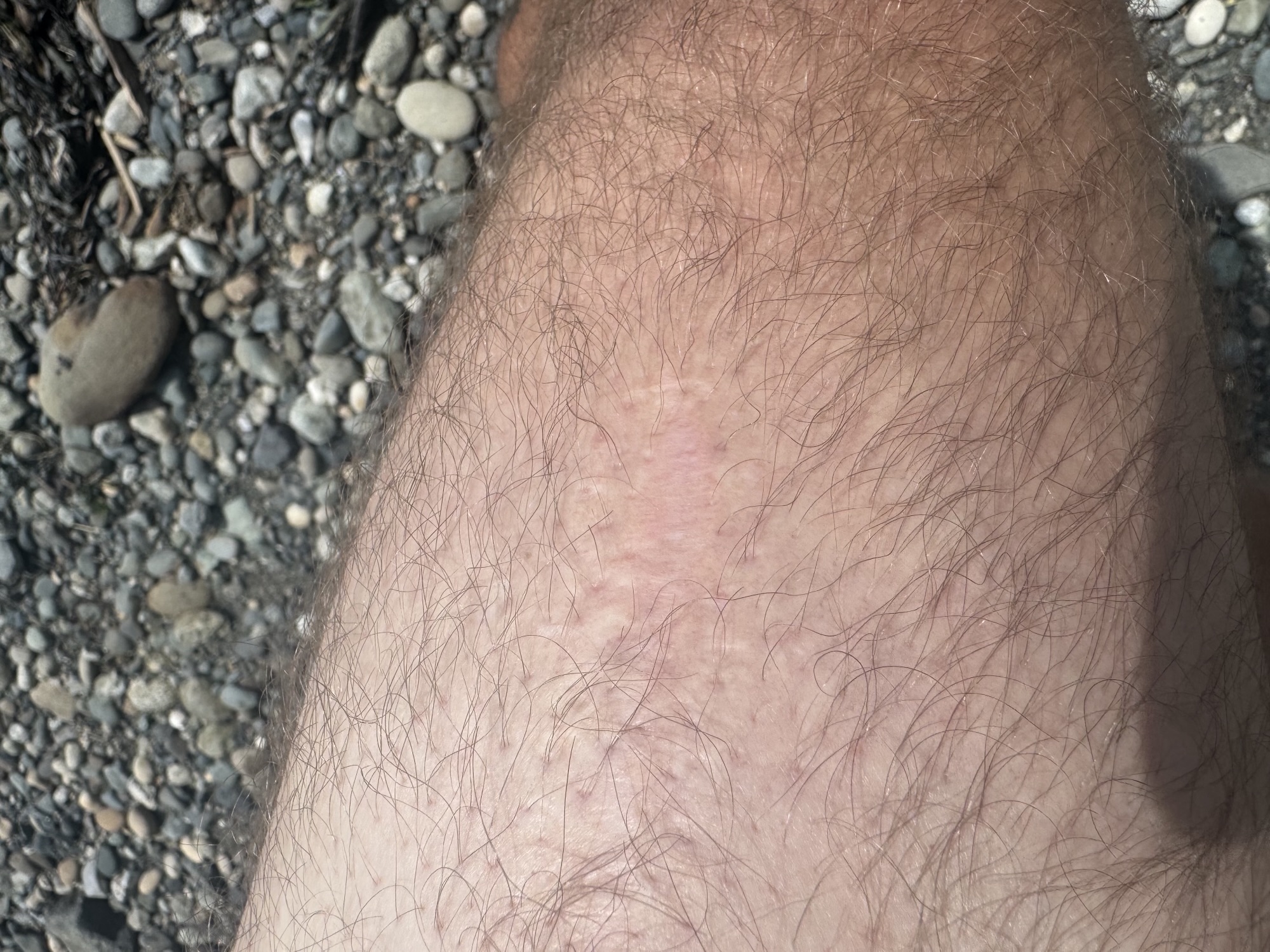 Grieving Scars v1.0